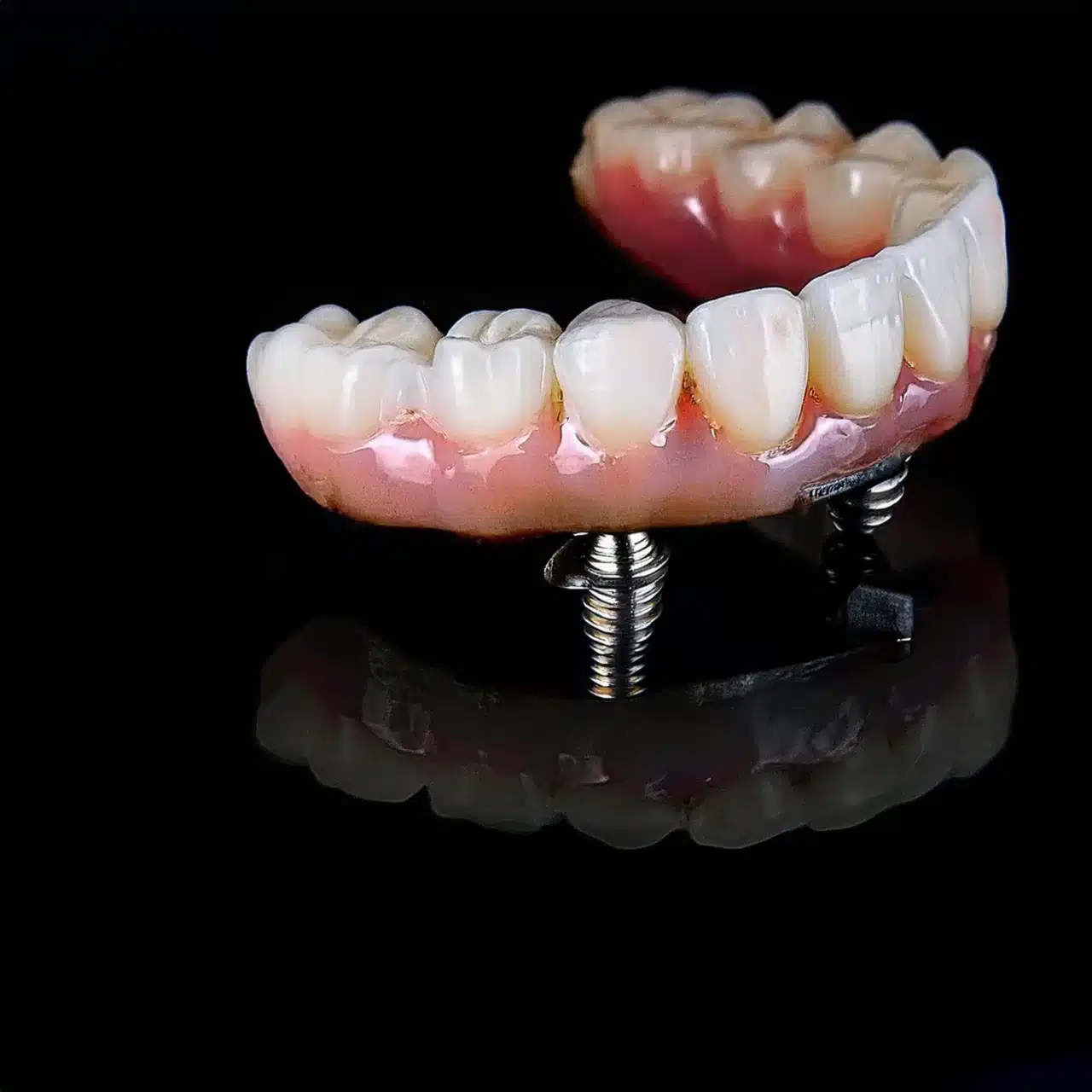 Full arch dental implants