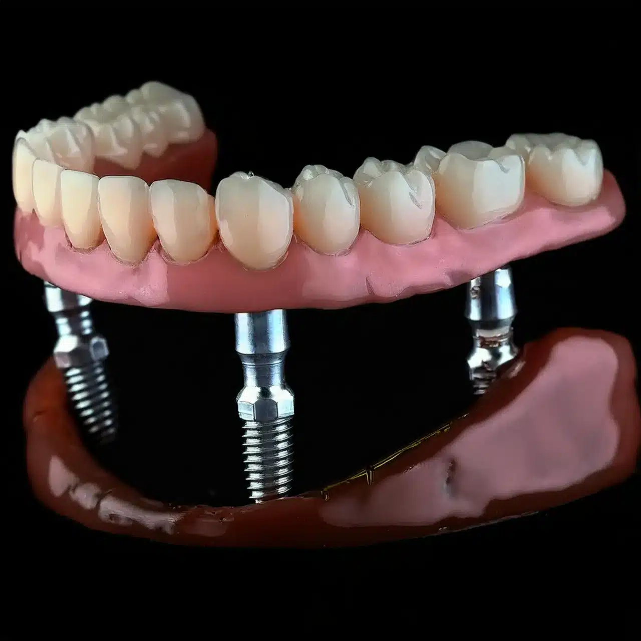 Transosteal dental implants