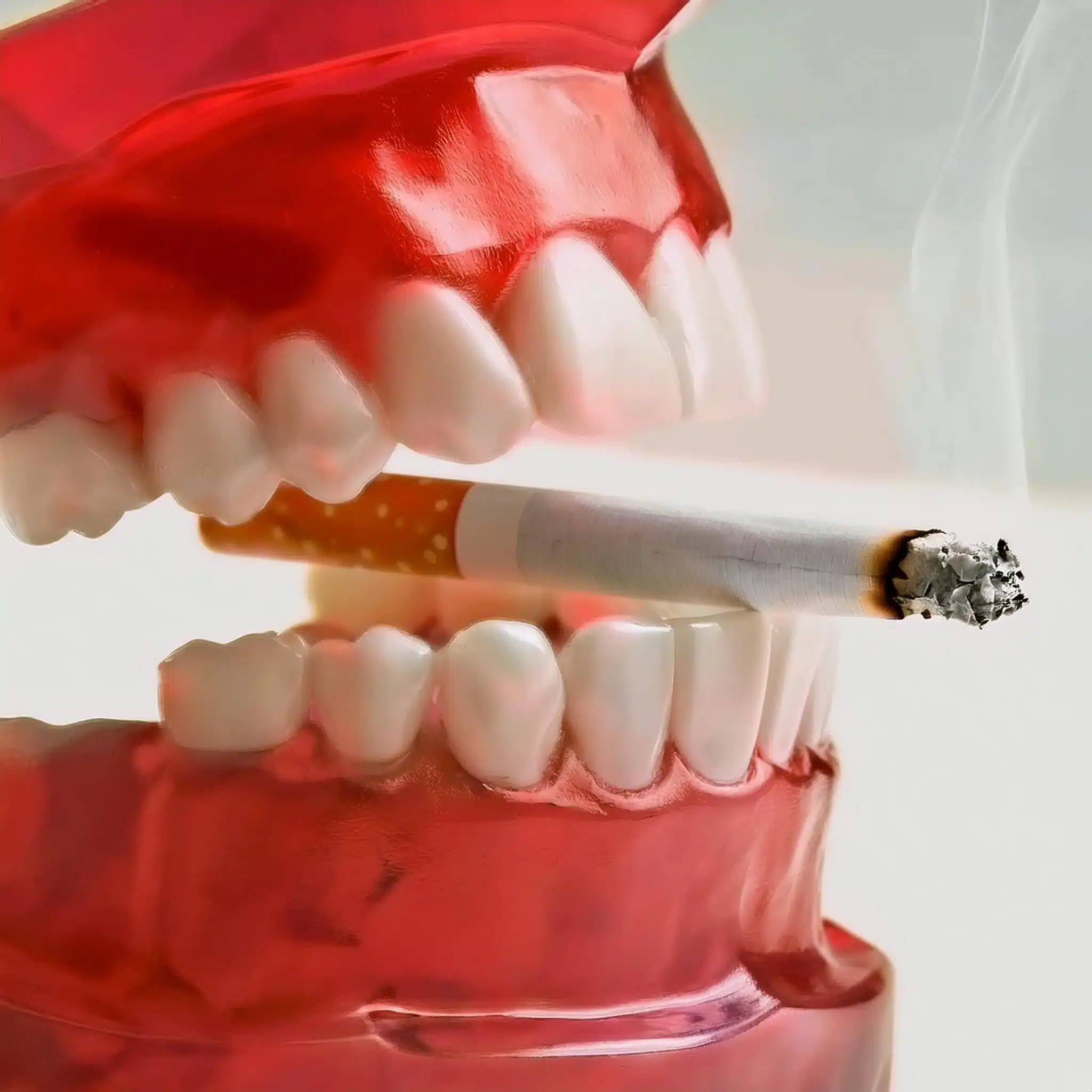 Dental implants and smoking