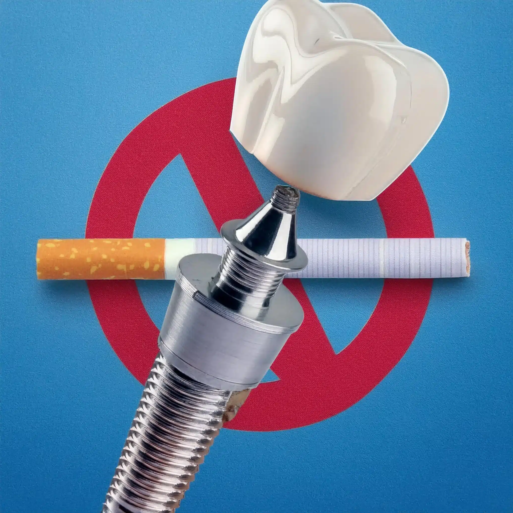 No smoking during and after dental implants