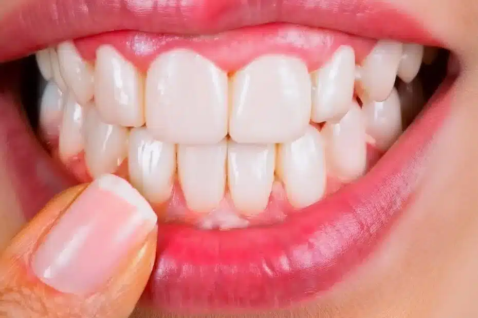 Firefly Krijo një foto realiste dhe 3D të të gjithave në 4 implante dentare 49929