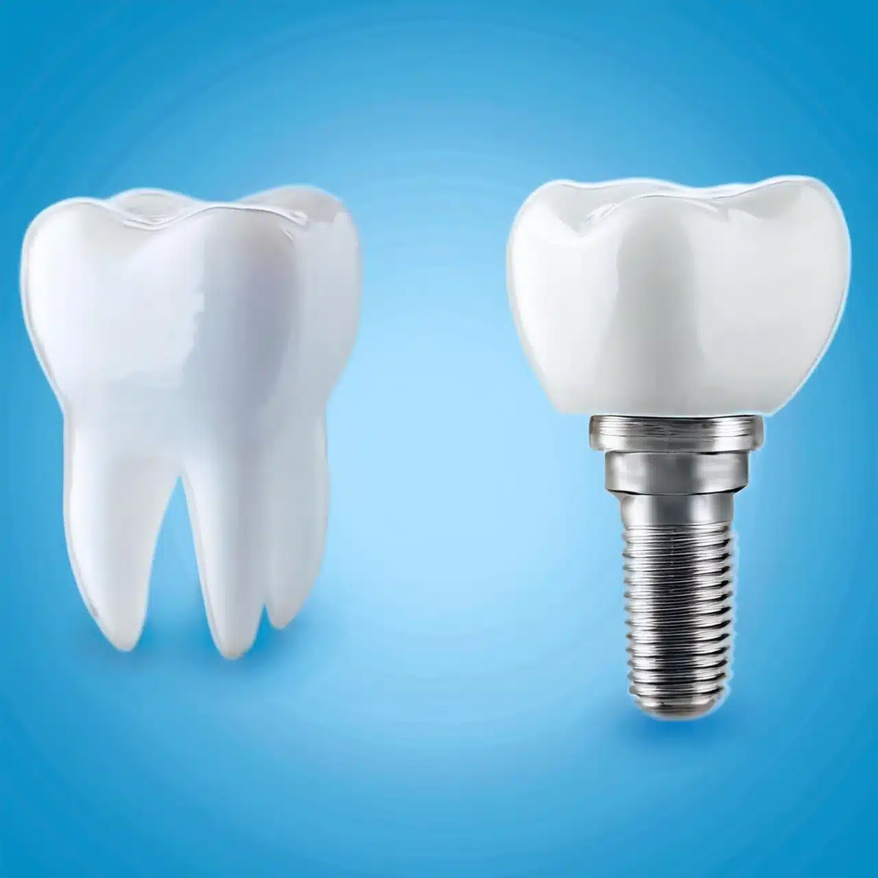 Denti veri vs impianto dentale