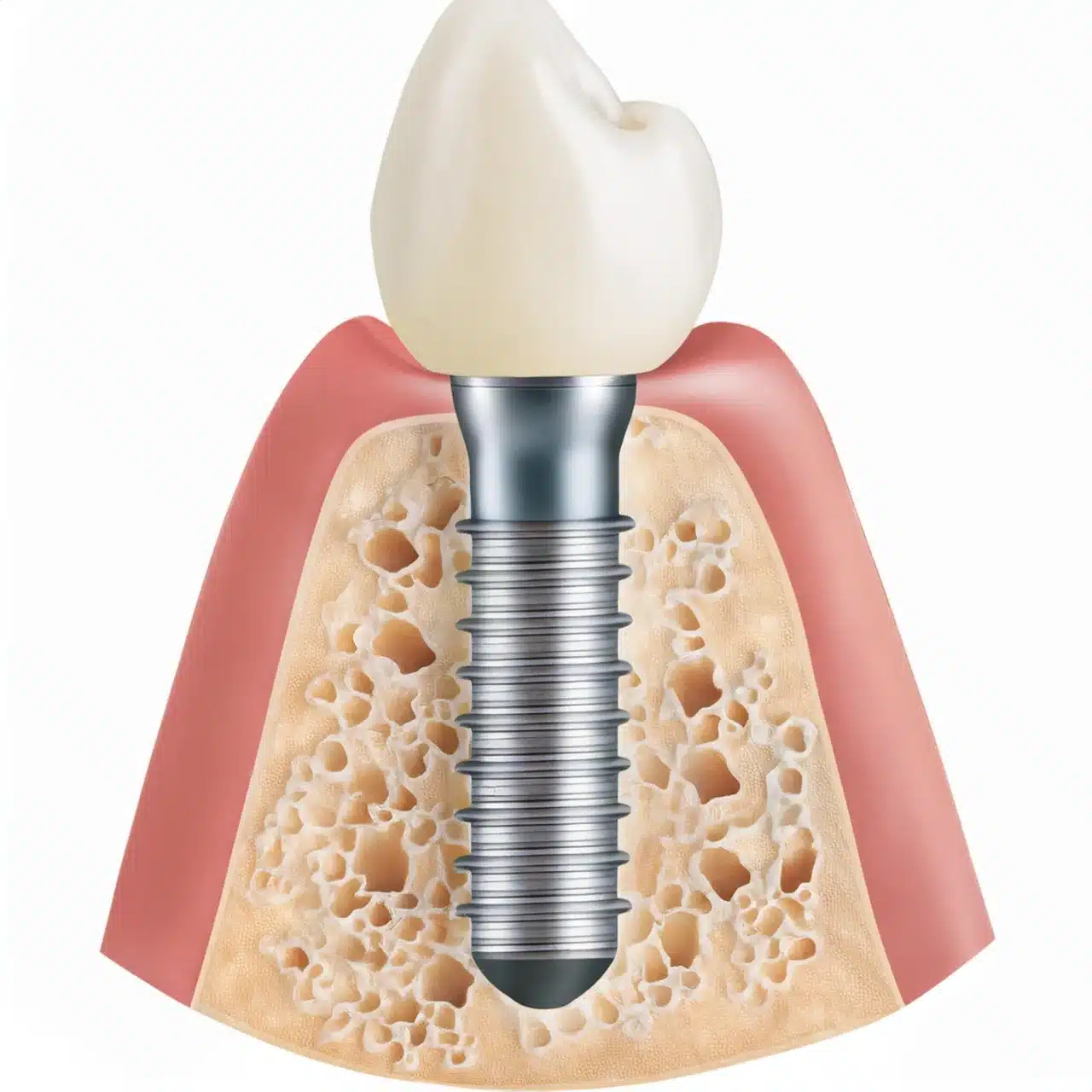 Dental implant passport