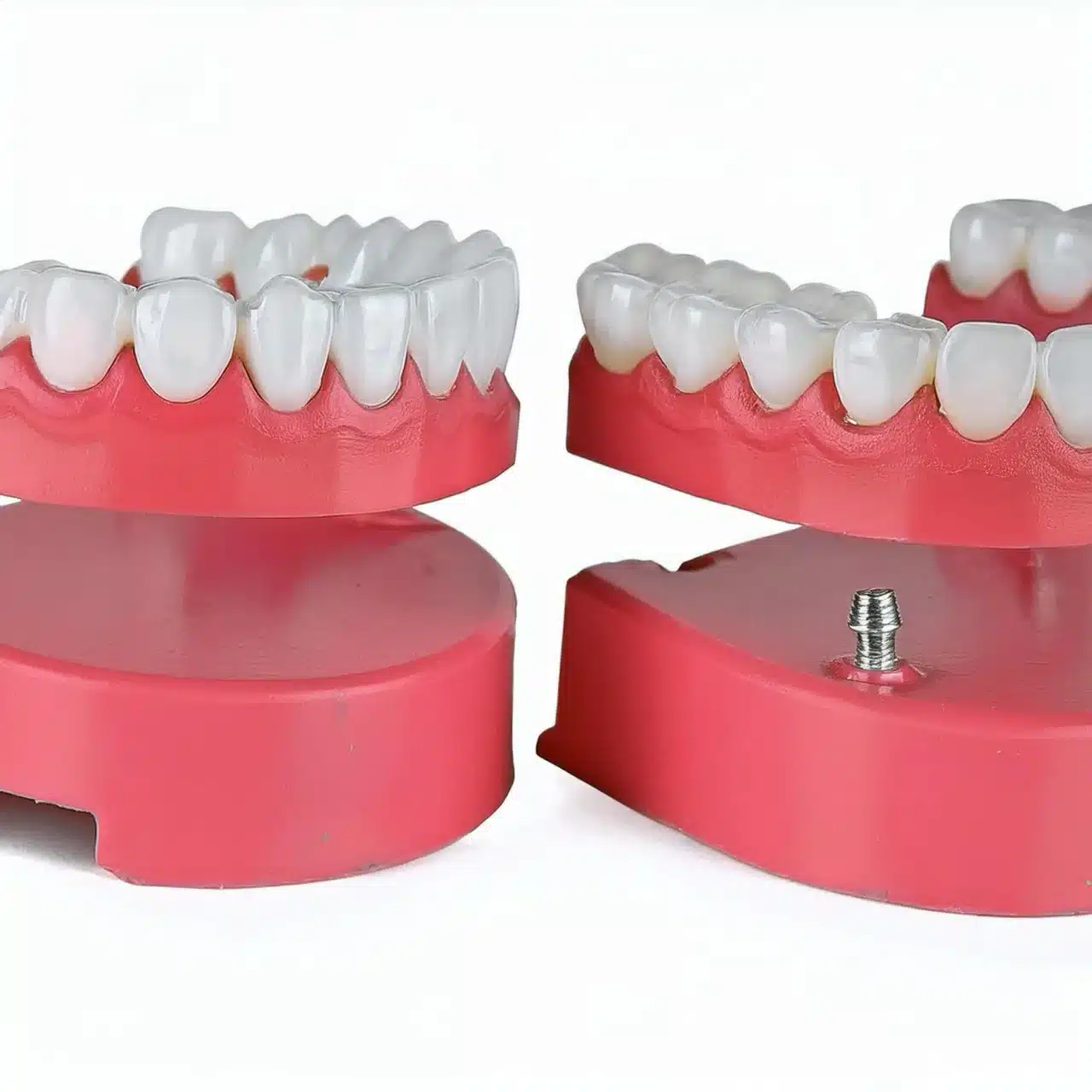 Dentaduras postizas frente a implantes dentales