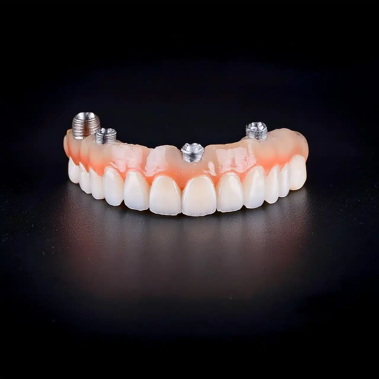 implants for upper arch