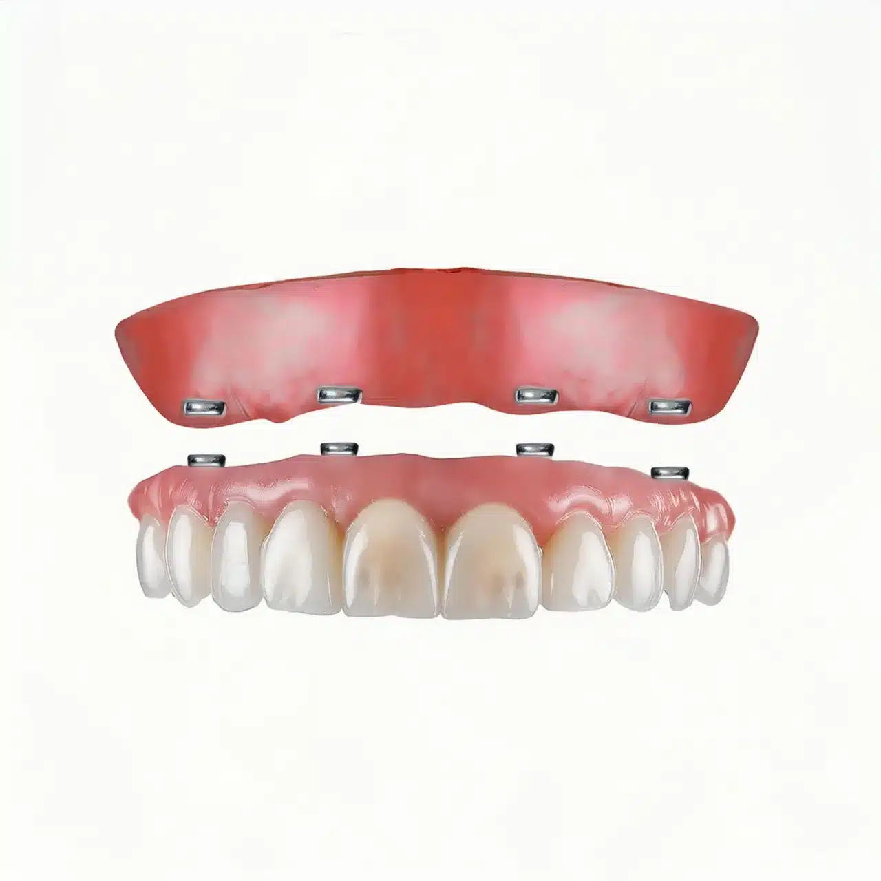 3D plan of full mouth all on 4