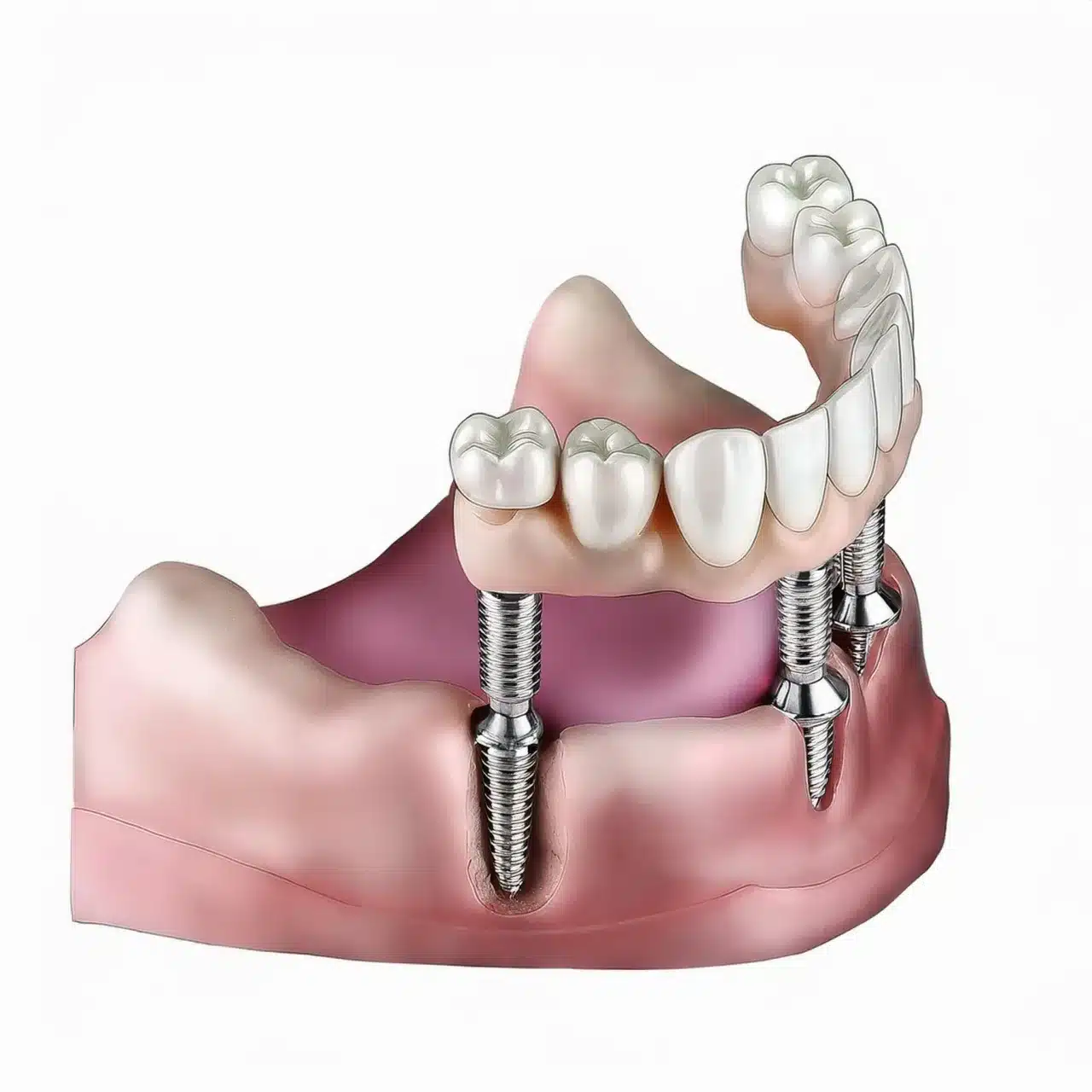 3D plan of all on 4