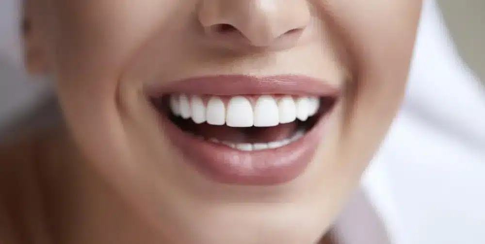 Smiling with new dental implants