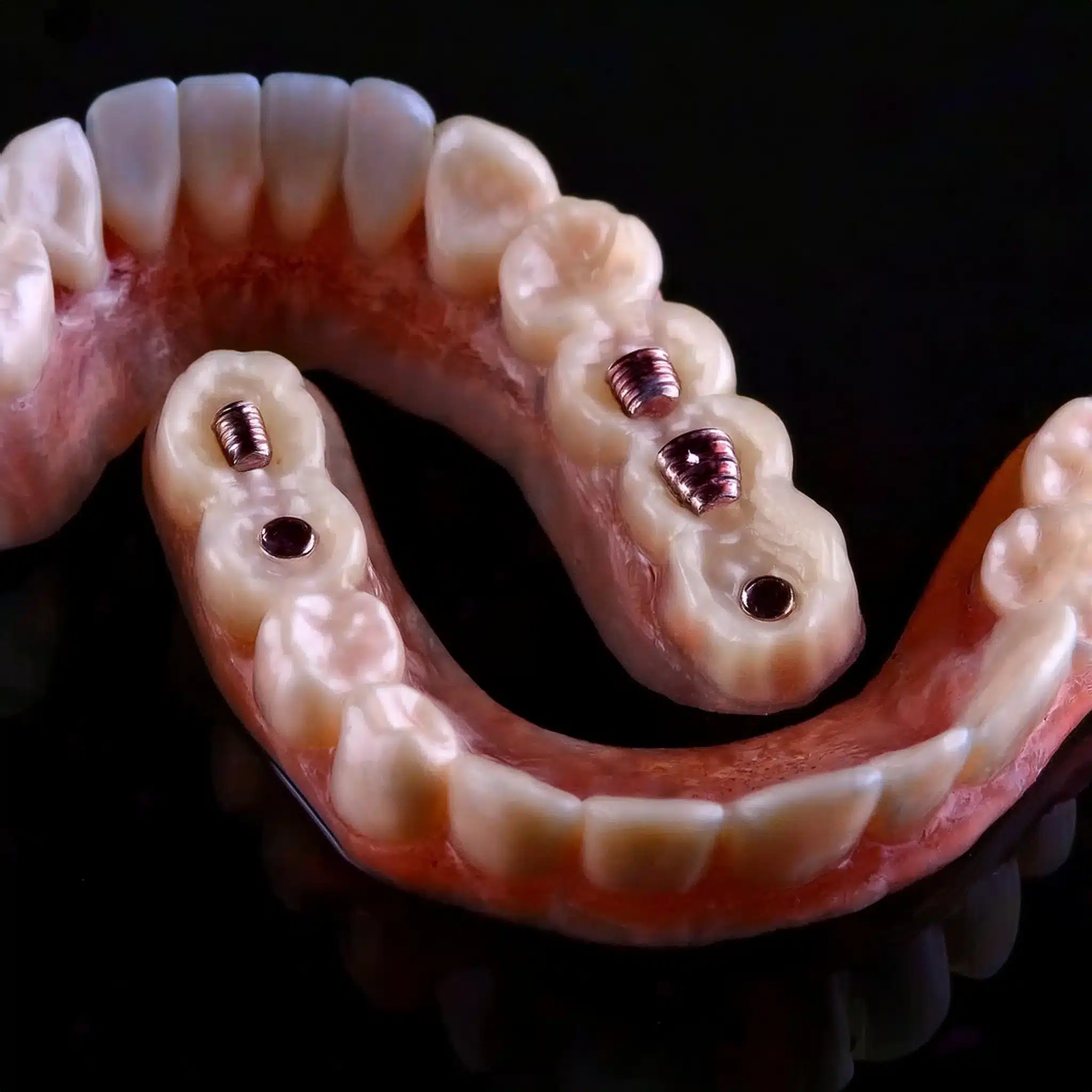 Firefly Generieren Sie ein realistisches 3D-Foto von allen 6 Zahnimplantaten. 18095