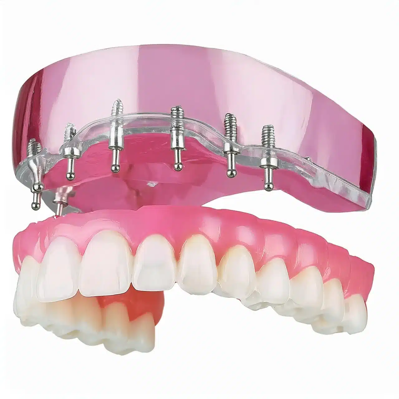 Plano 3D de implantes dentales All-on-8