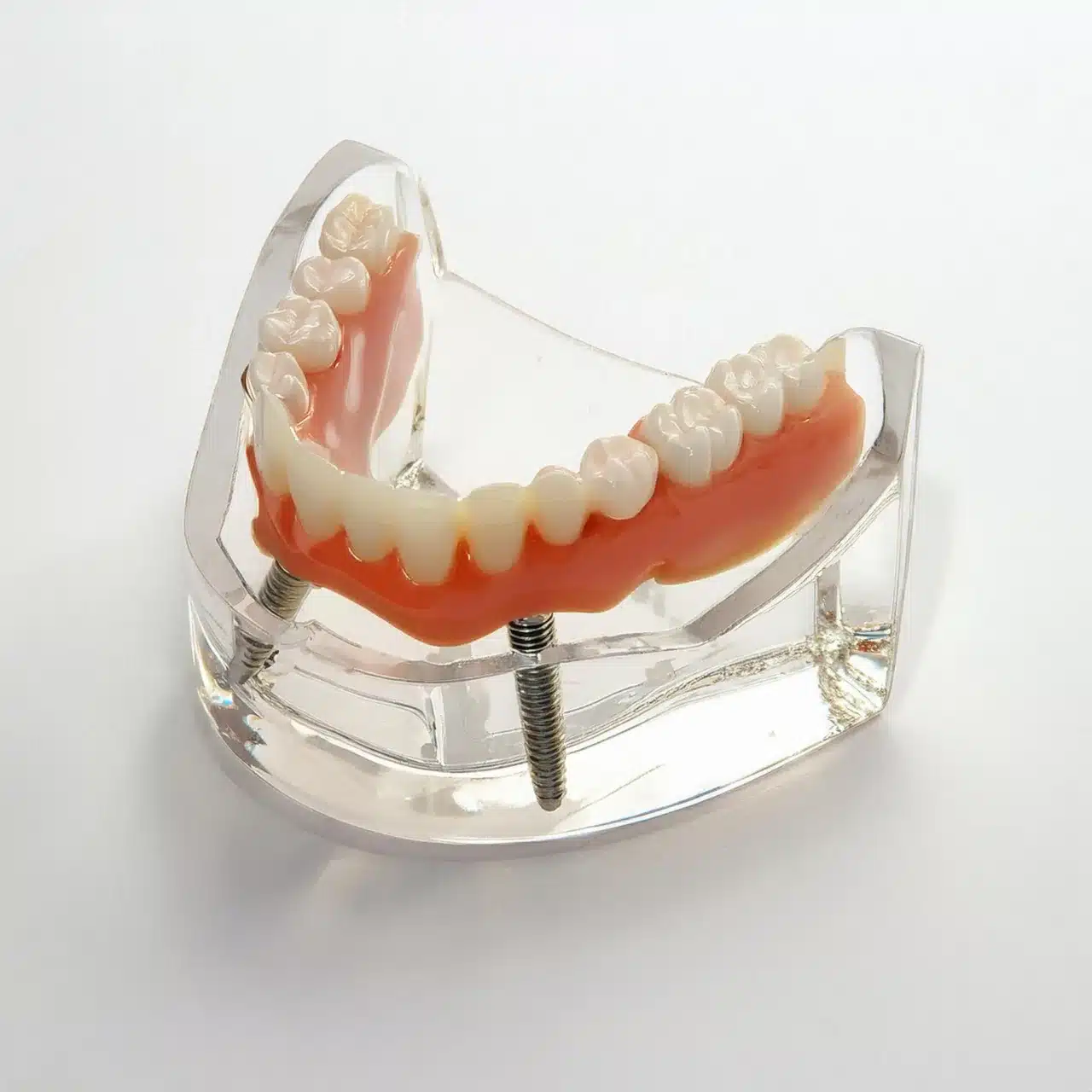 3D plan of all-on-8 dental implants