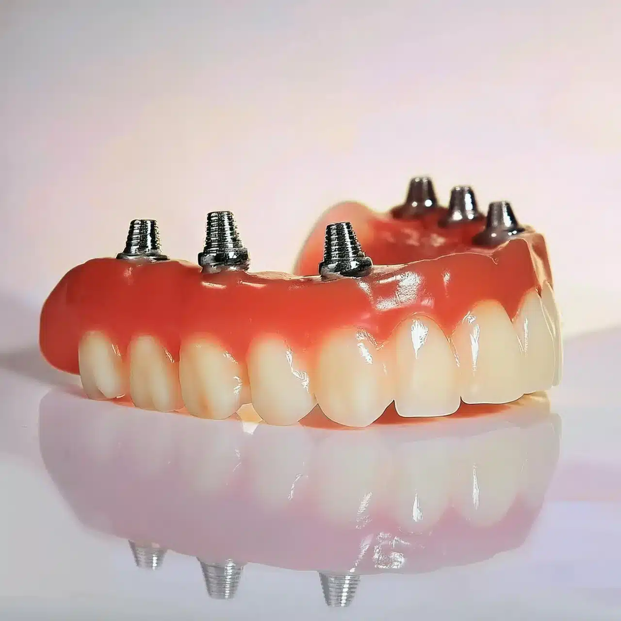 All on 6 dental implants, 3D plan