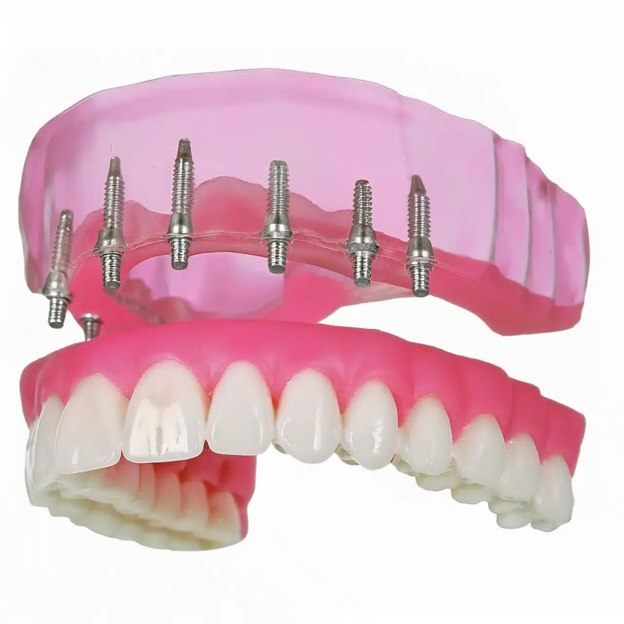 All-on-8 dental implants