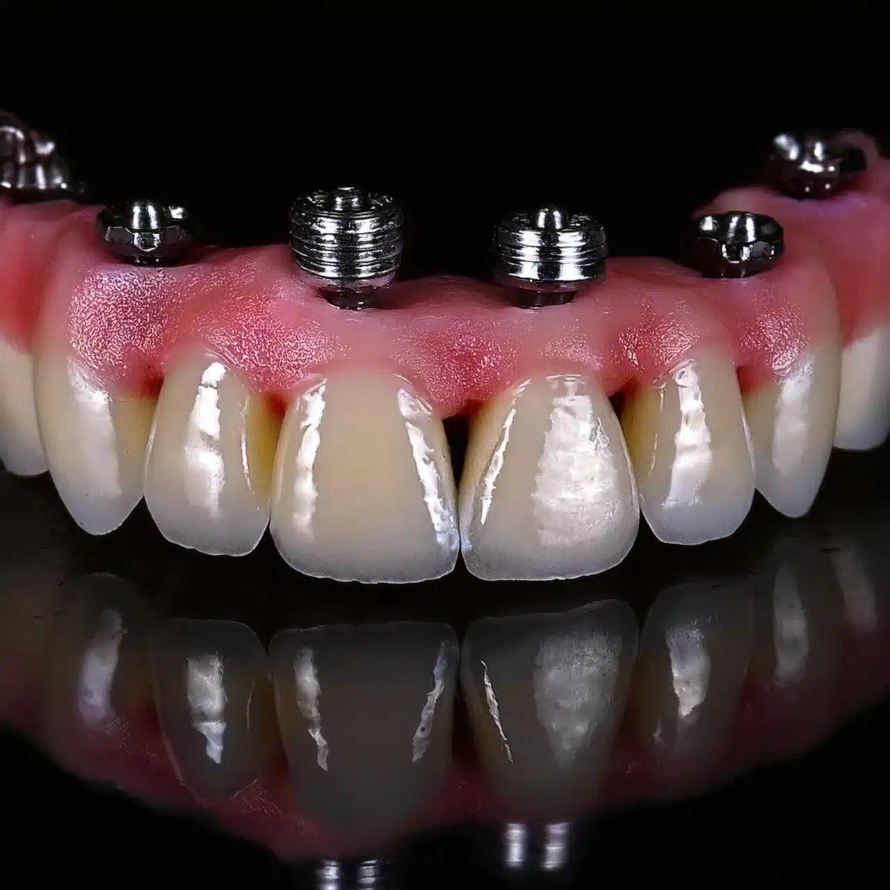 Mantenimiento de implantes dentales All-on-8