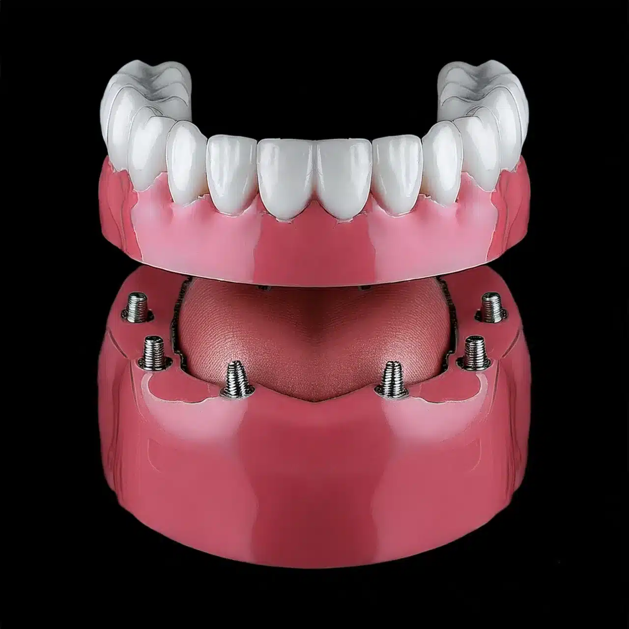 Mantenimiento de implantes dentales All-on-8