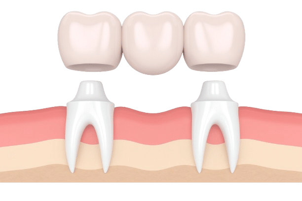 ChatGPT Image Nov 20 2025 01 03 31 PM removebg preview