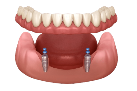 ChatGPT_Image_Nov_27__2025__05_40_16_PM-removebg-preview